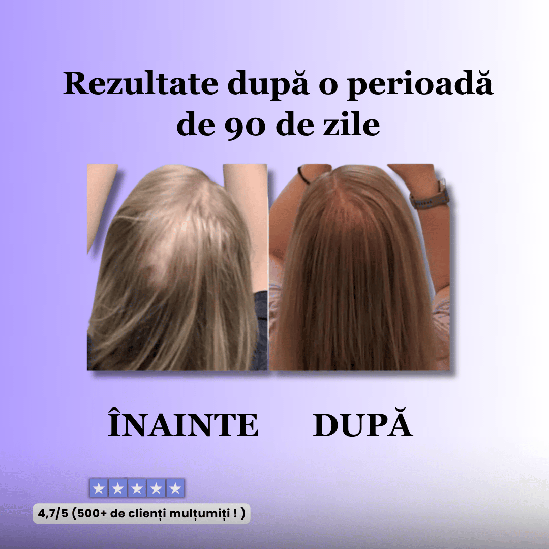 Perie pentru stimularea creșterii părului - ReVibe™