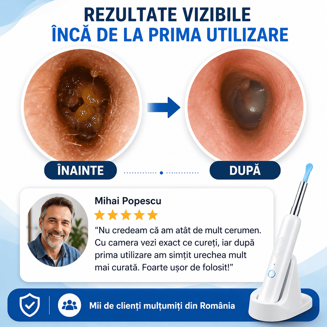 Dispozitiv pentru Curățarea Urechilor cu Cameră HD