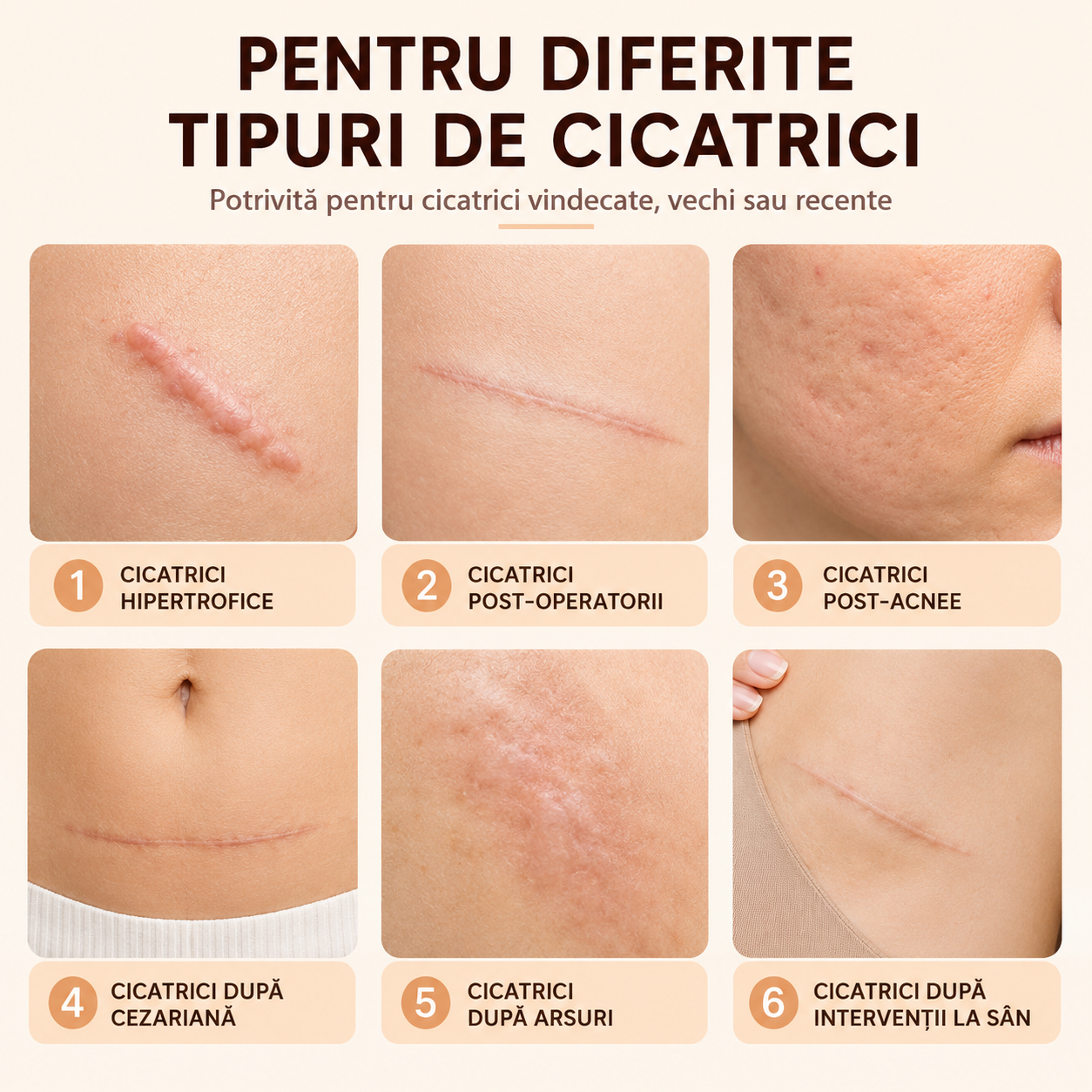 Bandă din silicon medical – 150 cm