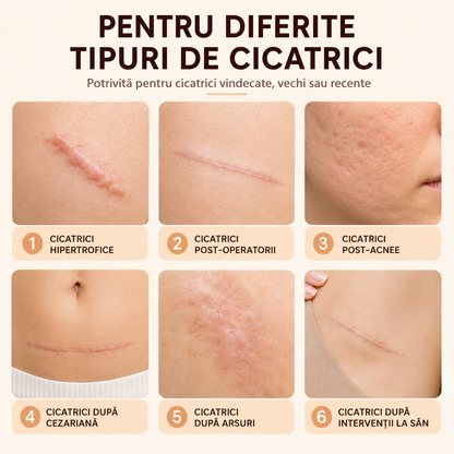 Bandă din silicon medical – 150 cm