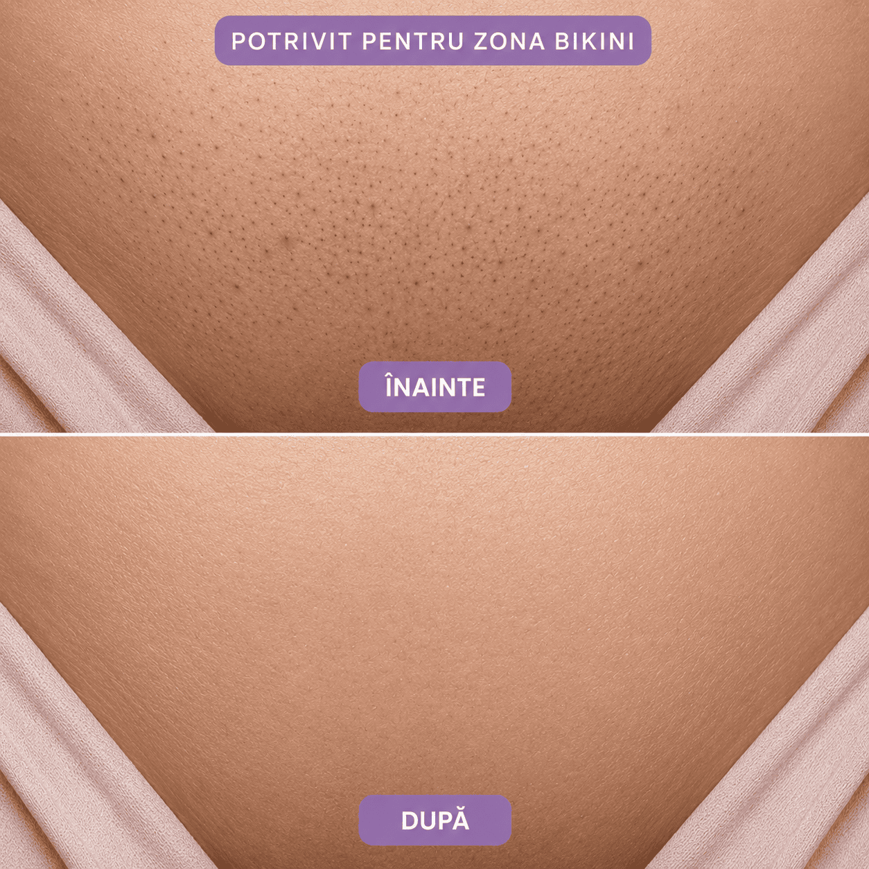 Ser Anticreștere a Firelor de Păr cu Cyperus Rotundus