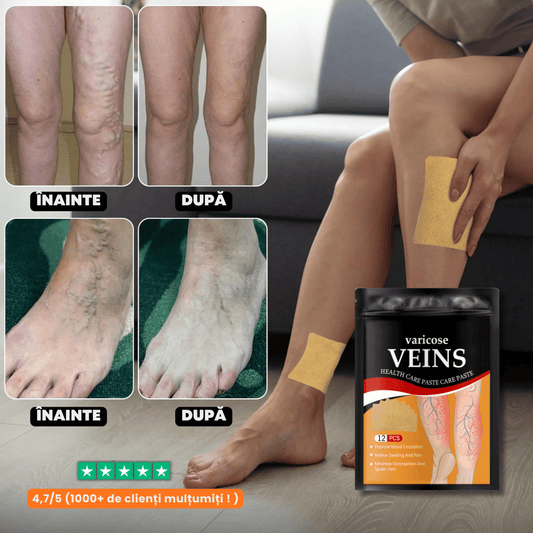 Plasturi naturali pentru varice și picioare obosite – StopVarix™