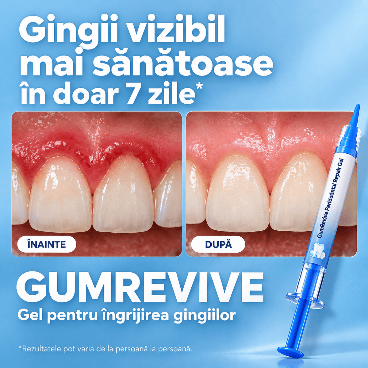 Gel pentru Îngrijirea Gingiilor - GumRevive™