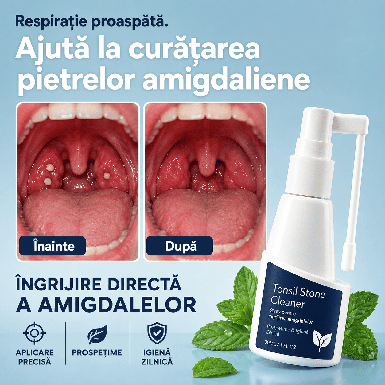 Spray pentru Îndepărtarea Pietrelor Amigdaliene