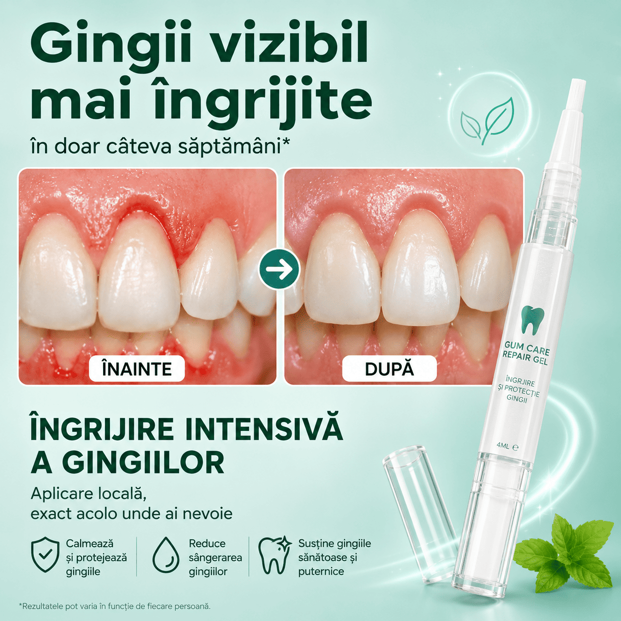 Gel pentru Îngrijirea și Revitalizarea Gingiilor