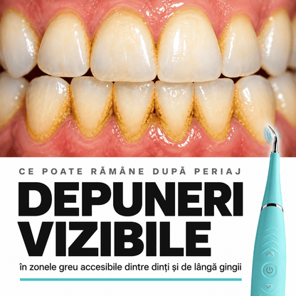 Scaler Dentar Electric - DentaPure™