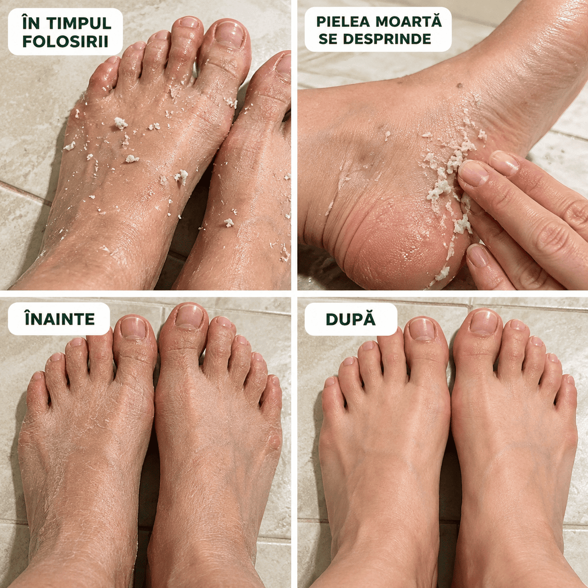 Spray Exfoliant pentru Picioare - 100 ml