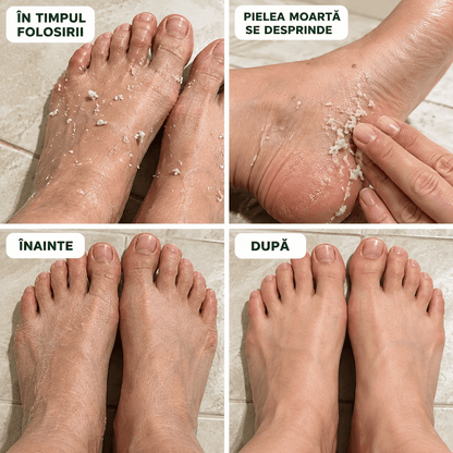 Spray Exfoliant pentru Picioare - 100 ml