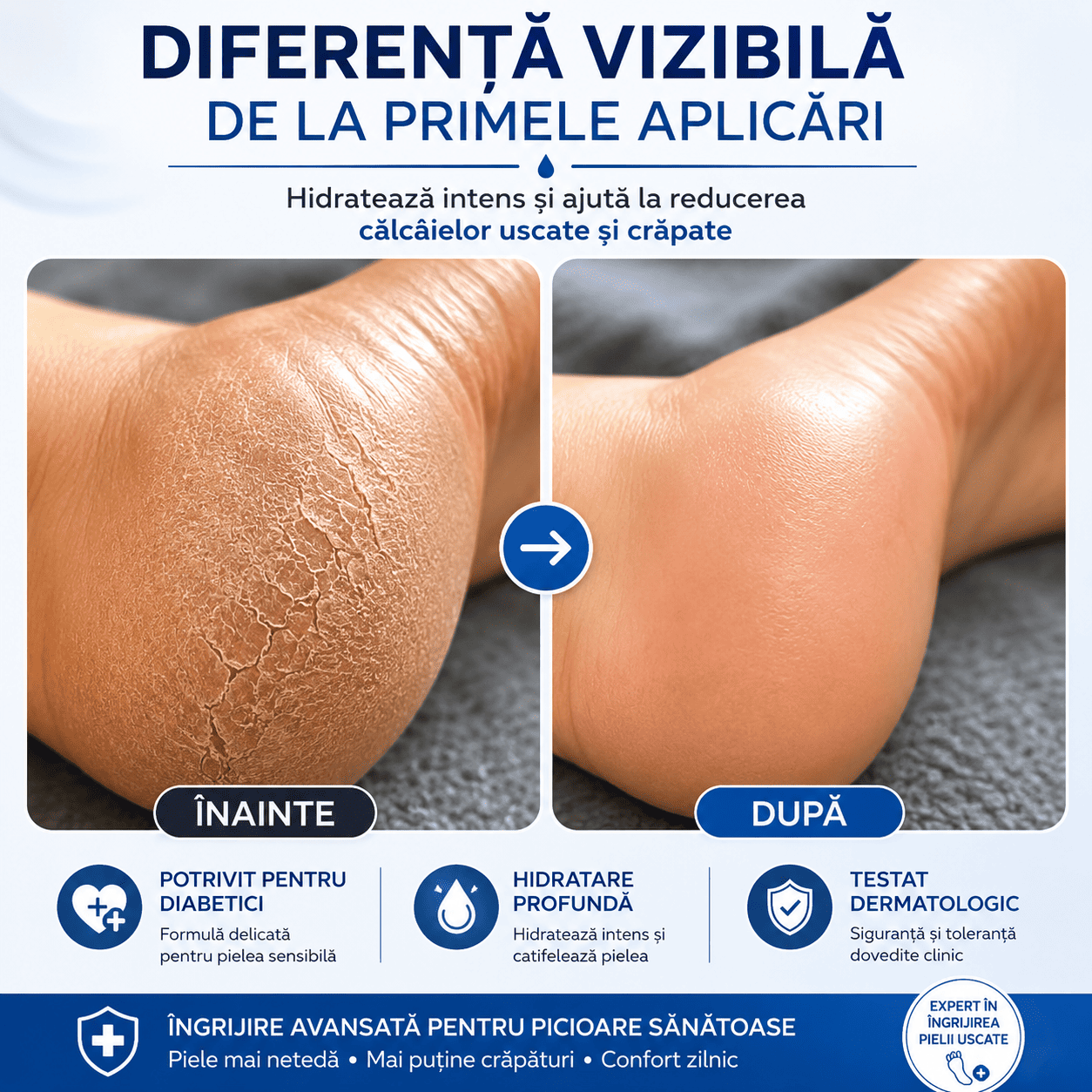 Cremă Reparatoare pentru Călcâie Crăpate