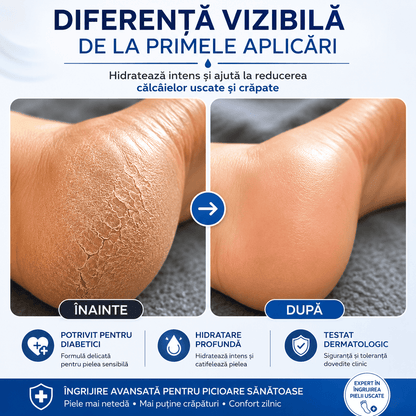 Cremă Reparatoare pentru Călcâie Crăpate
