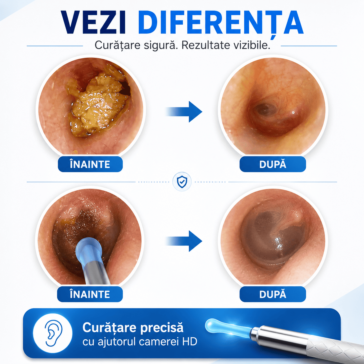 Dispozitiv pentru Curățarea Urechilor cu Cameră HD