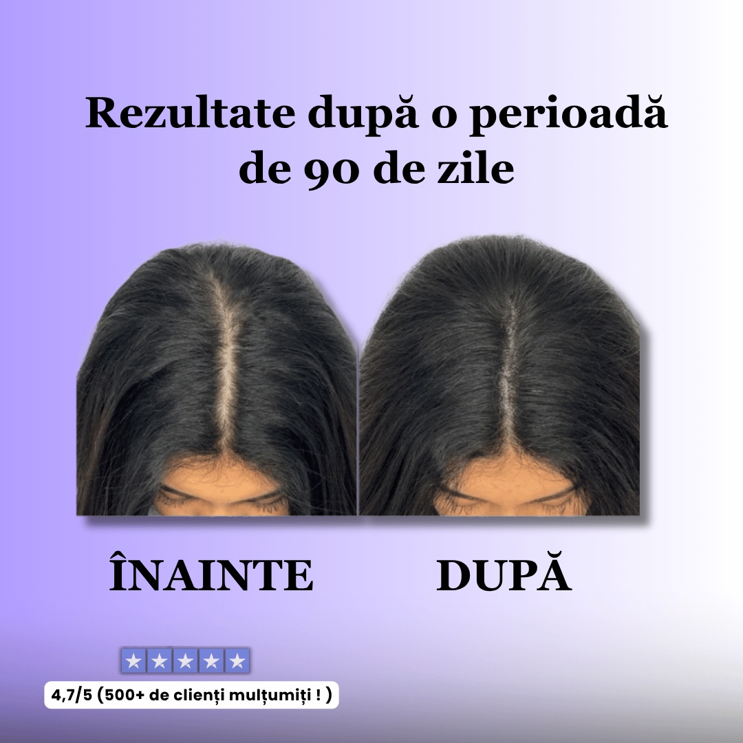 Perie pentru stimularea creșterii părului - ReVibe™