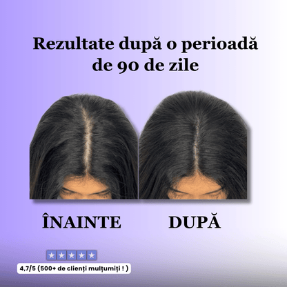 Perie pentru stimularea creșterii părului - ReVibe™