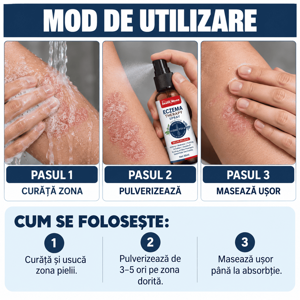 Spray Natural pentru Psoriazis și Mâncărime