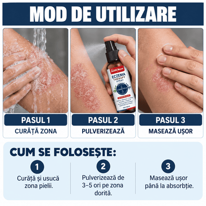 Spray Natural pentru Psoriazis și Mâncărime