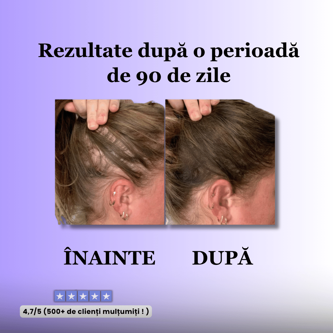 Perie pentru stimularea creșterii părului - ReVibe™