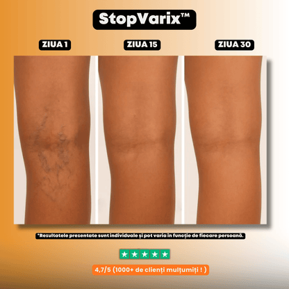 Plasturi naturali pentru varice și picioare obosite – StopVarix™