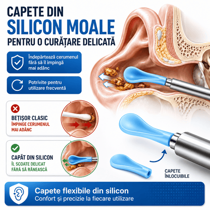 Dispozitiv pentru Curățarea Urechilor cu Cameră HD