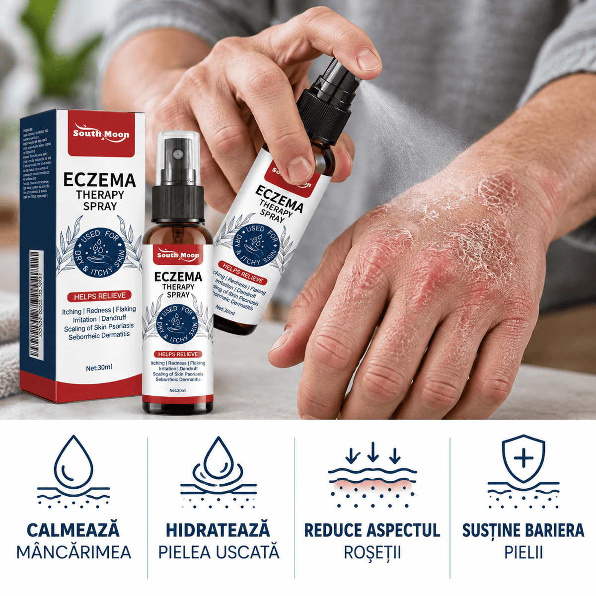 Spray Natural pentru Psoriazis și Mâncărime