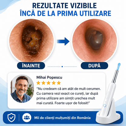 Dispozitiv pentru Curățarea Urechilor cu Cameră HD