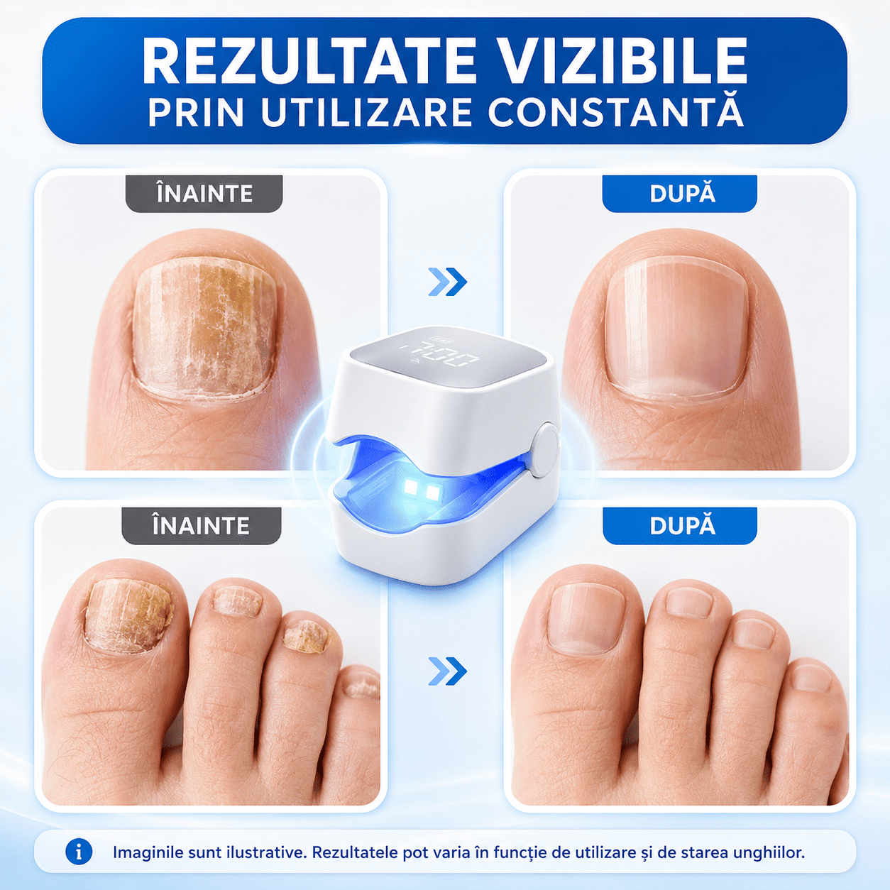 Dispozitiv pentru Îngrijirea Unghiilor cu Lumină Albastră